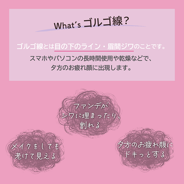 戈尔戈2号线